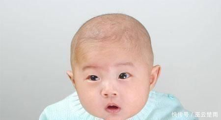 儿科医生|刚百天的孩子,大半夜哭闹,吓到爸妈,儿科医生幸好你俩没大意