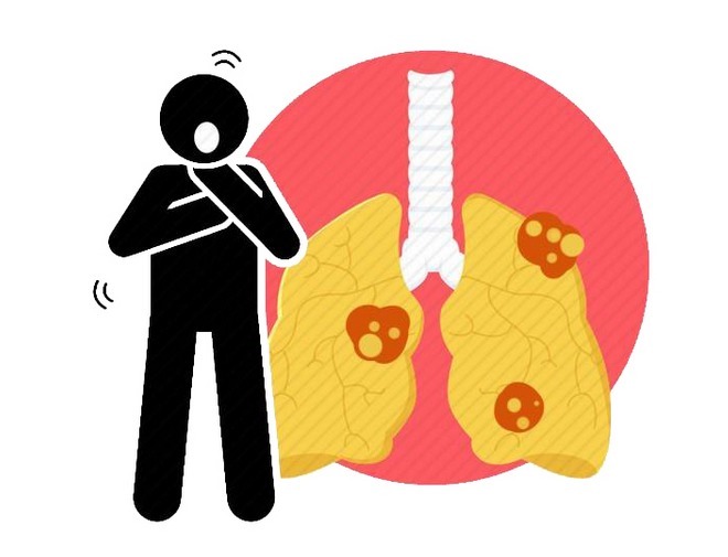 患有|肩膀痛可能不单单是肩周炎这么简单！这样区别好，尽快针对治疗