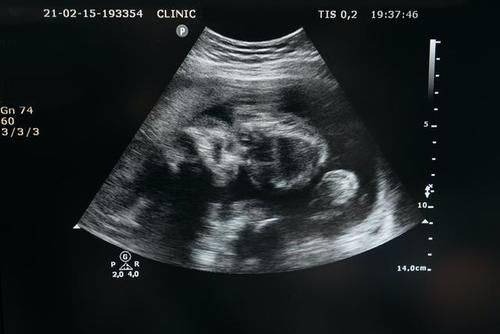 胎儿在母亲的肚子里能看到什么？