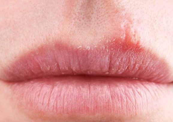 胆汁|“肝不好,嘴先知”!嘴巴若出现这些情况,说明肝脏八成出问题了