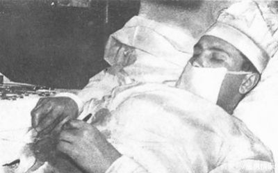 阑尾|给自己做手术 早就有医生干过