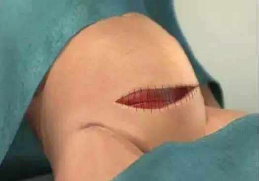 春夏秋冬|37岁农村大叔恋上18岁少女,少女一登场,涂磊:换我也喜欢