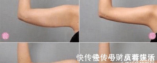 拉力器|男性前列腺，最怕哪些坏习惯？1分钟自测前列腺健康，达标的不多