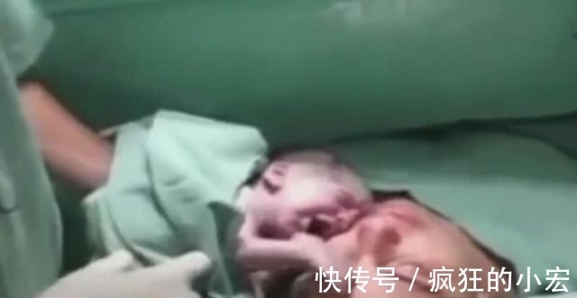 医师|妈妈刚刚生下孩子就停止心跳,宝宝伸手摸着母亲脸庞,奇迹出现了