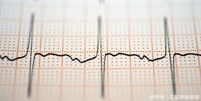 心梗的10个不同报警症状,别假装听不见!3个检查就能诊断