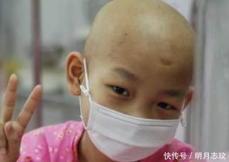 男女|白血病多“青睐”儿童?不论男女,身体若有这“3表现”,要及时就医!