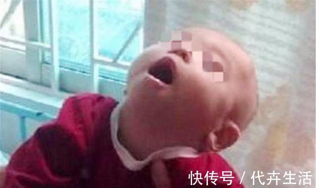 父母|宝宝抬头太早不是好事，父母别当发育快沾沾自喜，可能是异常信号