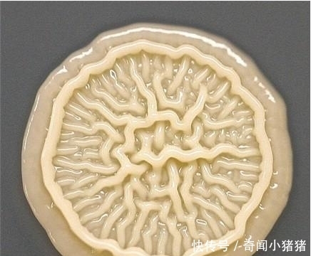 8岁小孩出去玩,回家不洗手按了个手印,妈妈培养48小时后