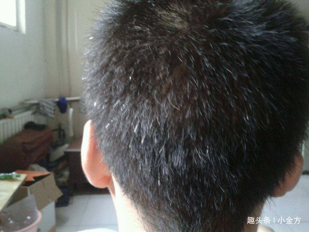 潮热|更年期第一方,潮热、盗汗、头晕、耳鸣、腰痛,2味药完美解决!