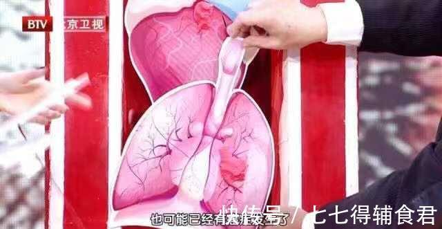 酒精|去年超74万人因它患癌，居然还有人用它来养生！劝你不碰为好