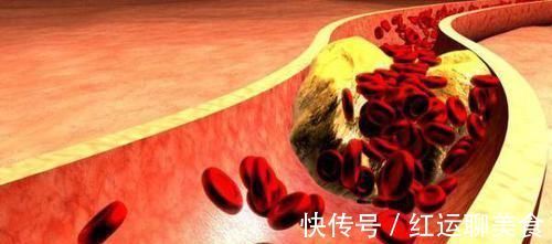 常吃|血管堵,百病生!4种食物常吃点,有助血管通畅,身体更健康