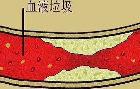 过了50岁,如果还没得过此些病,或许活到99岁不是梦,易长寿