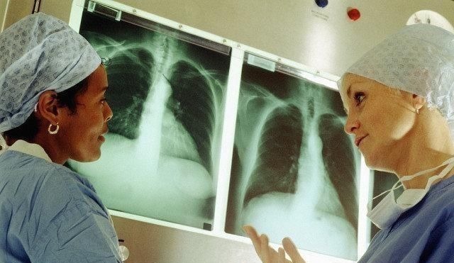 胸腔积液|做了肺癌切除手术后走路都喘,是真的吗专家却这样回答