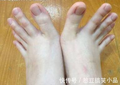 腿部肌肉|人到中年,脚上若还有4个特征,恭喜了,你是健康长寿体质