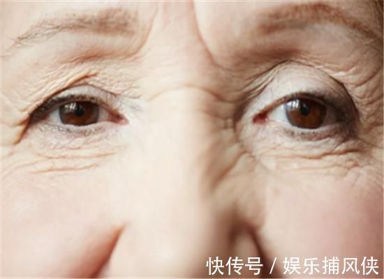 视力|“糖尿病”多是拖出来的,身体“3处”出现反常,可能血糖已高!