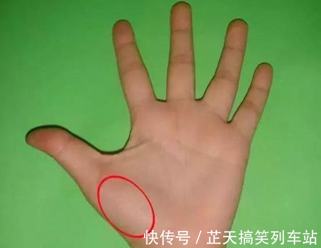 发黄|肝是“哑巴”，如何判断肝好不好？若有这5体征，抽空去趟肿瘤科