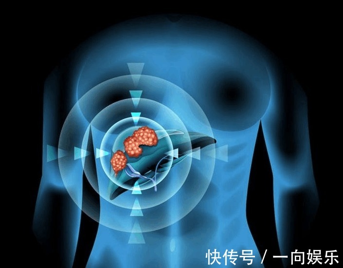 糖尿病患者|多吃西红柿可以预防肝癌新加坡研究了25年，结论出来了