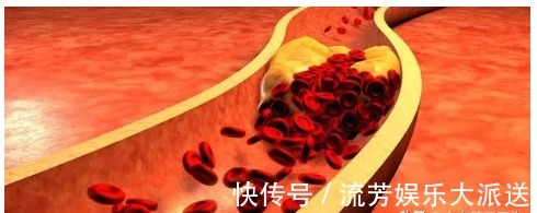 血脂|医生舅舅高血脂,为什么医生说不用吃药,先这样血脂也能正常
