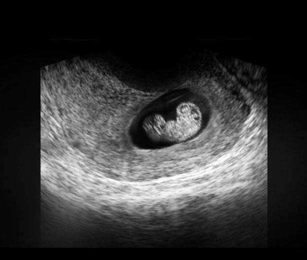 性别|胎儿从卵泡到性别形成,17张图片清晰诠释,男宝女宝看得很清楚