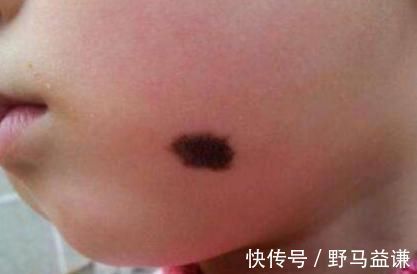 化妆|怀孕后,孕妈常有这3个“坏习惯”,宝宝易长胎记,一定要多留心