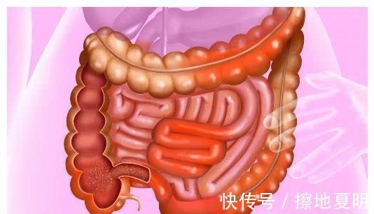 患者|患上这三种癌,算不幸中的万幸:合理治疗,或能健康