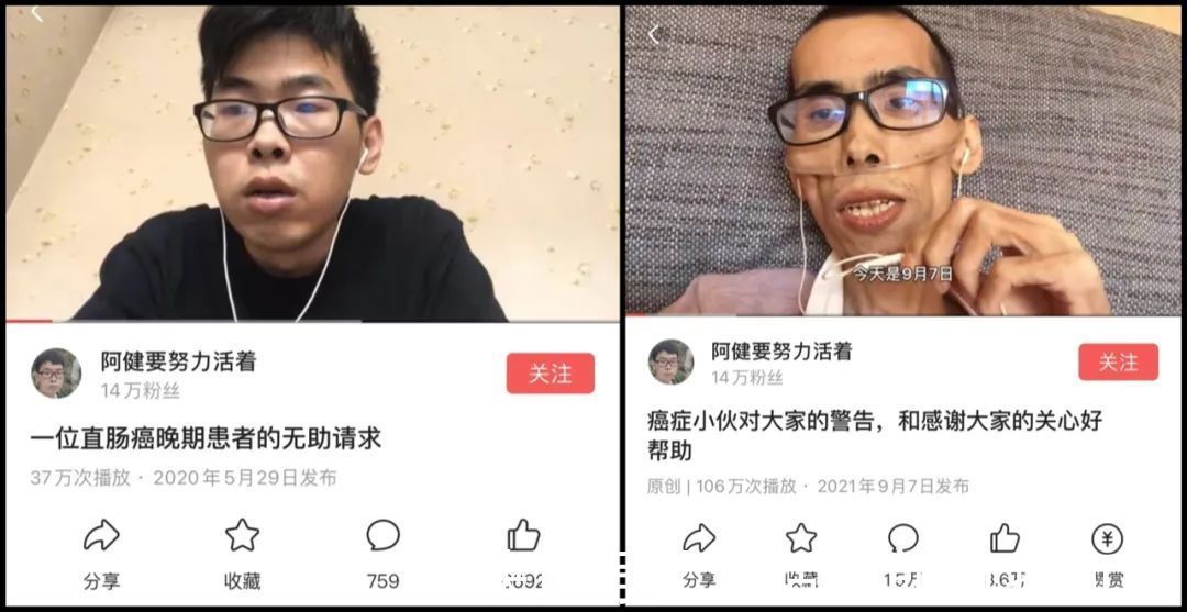 阿健|直肠癌多半是“拖”出来的!医生提醒:身体有2个感受,抓紧检查