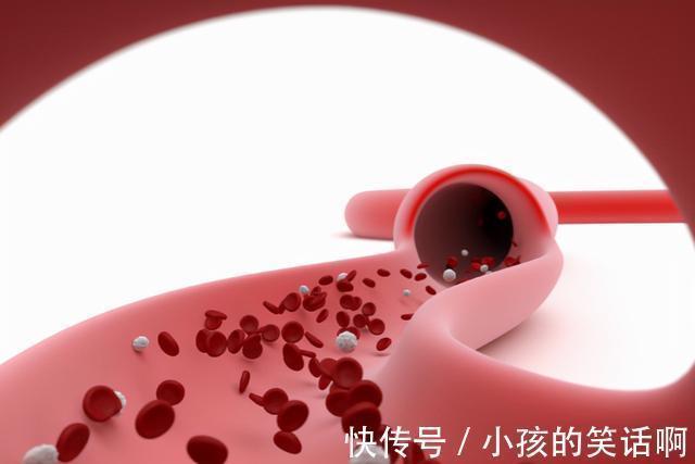 营养物质|多走路可以降血脂?医生提醒:3种食物常吃或比走路效果更好