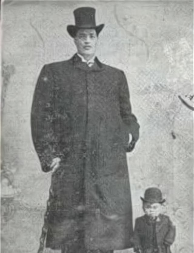 身高|雷纳尔:前半生是1米22的侏儒,后半生是2米16的巨人,他经历了啥