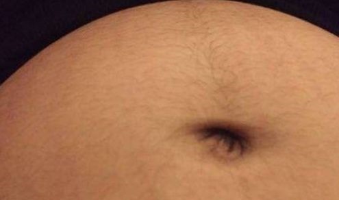 儿科医生|生男生女?可以从孕肚上的一条神秘“黑线”看出?答案让人暖心