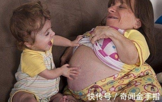 袖珍妈妈|美国身高70厘米的袖珍妈妈,身体肿如气球,如今俩孩子
