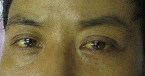 头上|大病来临前,头上也会发出“求救信号”,一旦发现就别大意