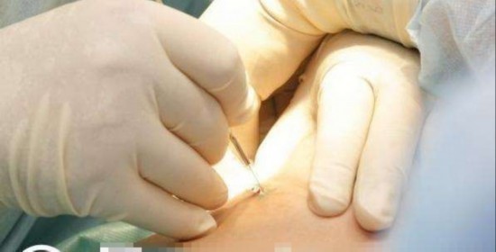 孕妇|孕妇生产三十四小时难产, 剖腹时竟没发现宝宝, 整个产房乱成一团