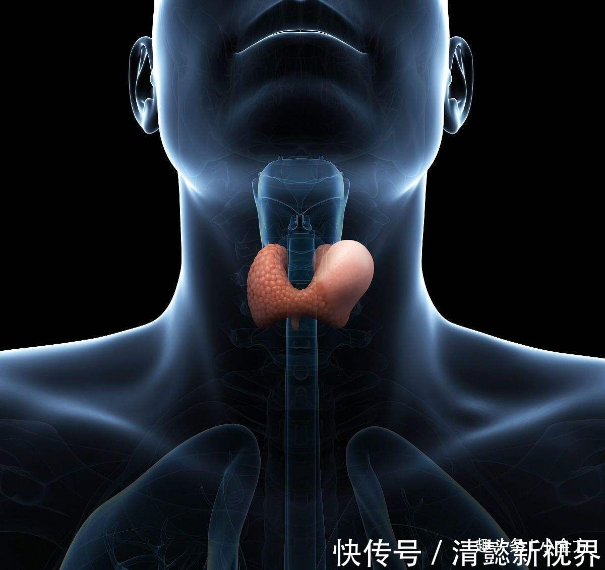 海带|神奇!喝了半个月的海带汤,甲状腺结节没了,还有一个中成药根治