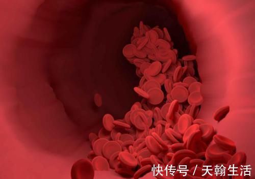 血管|当手上有这4个信号，表示血管堵塞很严重，要及时治疗