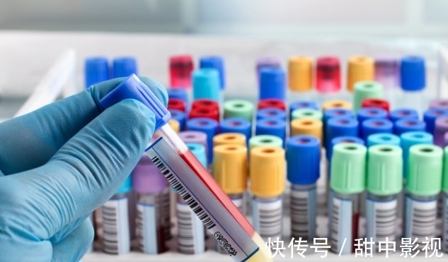 盐焗|28岁女子,确诊高血脂,医生:1种素食吃太多,血脂不降反升