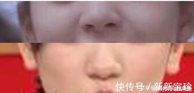 鼻头大鼻翼宽的女孩子