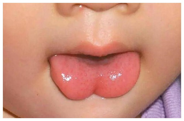 脾胃|苹果水能缓解小儿积食医生建议要想脾胃好,这2物要少吃