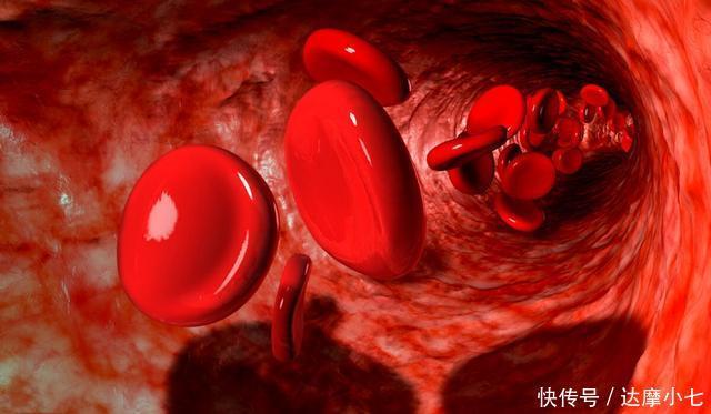 希望|高血脂的“3部曲”,希望你一个没有,专家:“吃”一物,血脂降