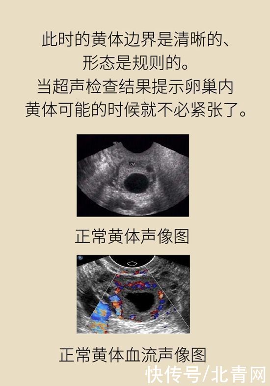 腹痛|这种腹痛常被误认宫外孕，背后诱因要牢记