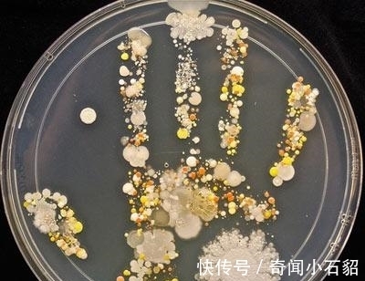 小孩|8岁小孩出去玩,回家不洗手按了个手印,妈妈培养48小时后