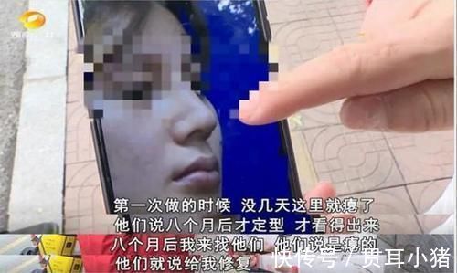 眼角膜 女子花60000整容,术后却整成“凹陷鼻”,找其理论主刀医生闭门不见