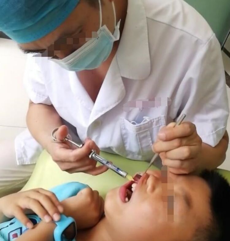 刷牙|7岁男孩长了“双排牙”,需要一颗一颗拔掉,奶奶:都怪我