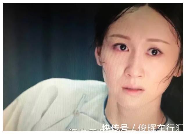 病理性黄疸|儿科医生:想要宝宝出生没黄疸,孕期坚持“3不做”,别不当回事