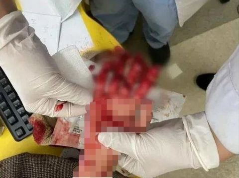 肌腱|妈妈深夜急哭!这个血的教训太惨痛,家长们千万要看住孩子