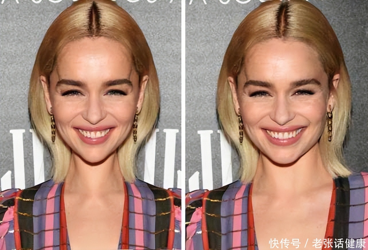 皮肤|长得好看的人,通常都会符合这5个标准,对照下,你占几个?