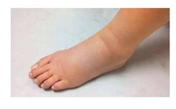 医生|痛风大多是“拖”出来的，医生：出现“2多2疼”，赶紧调理