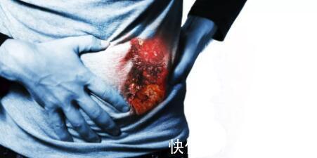 肝细胞|饭后这3个习惯,最易患上肝癌!再不改就晚了