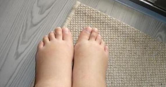 肾脏|“肾”好不好看脚，脚上如果没有以下4种情况，说明你的肾很健康