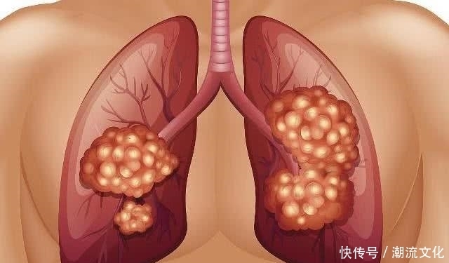 吸烟的人,若起床后有3个表现,你得抓紧戒烟了!