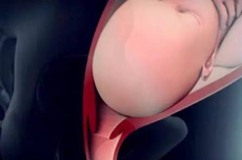 小子宫|产房分娩的过程是啥?实拍图还原顺产过程,看完明白为母则刚